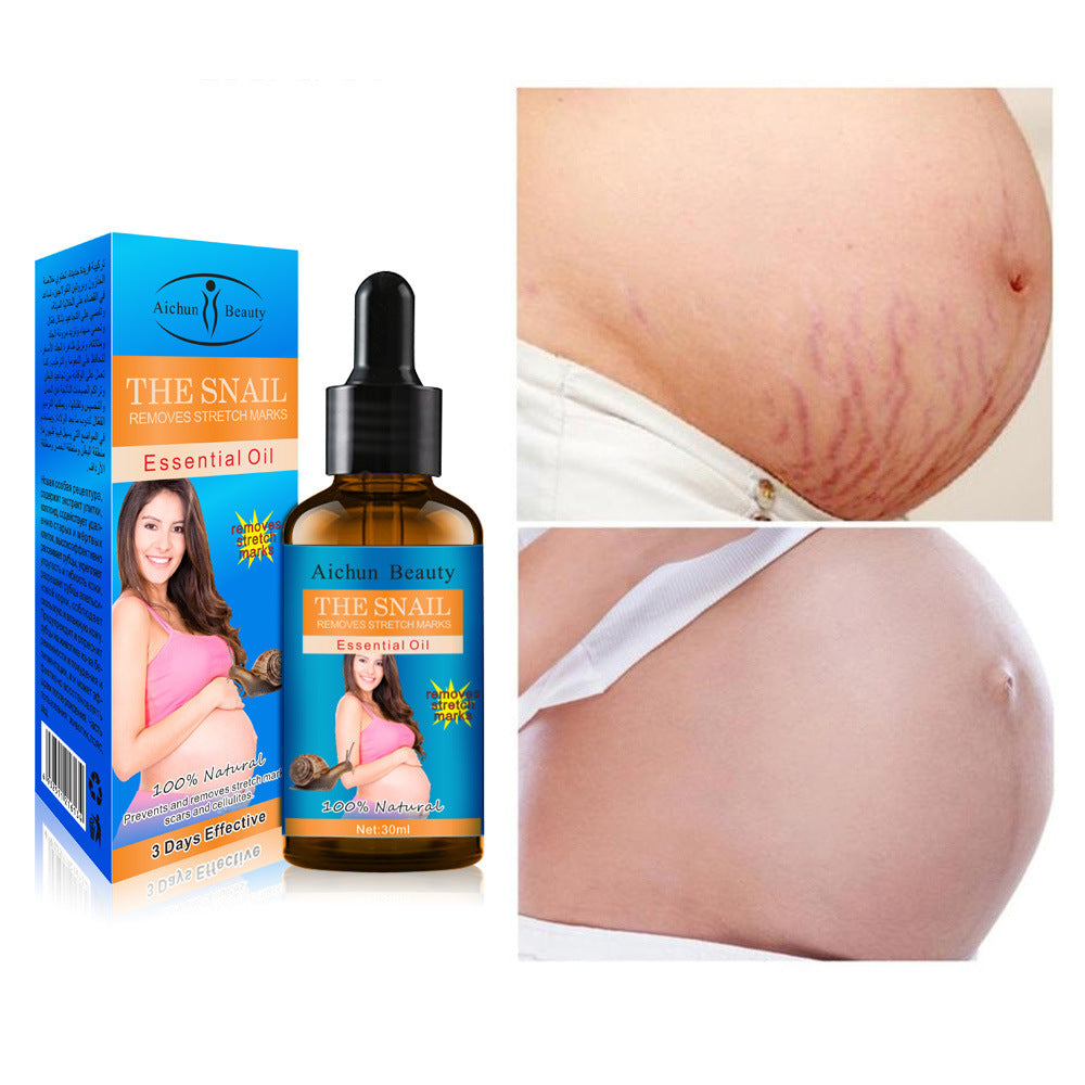 B-READY Herbal Stretch Mark & Belly Line Essential Oil To Fade Belly Lines B-READY WELLNESS
