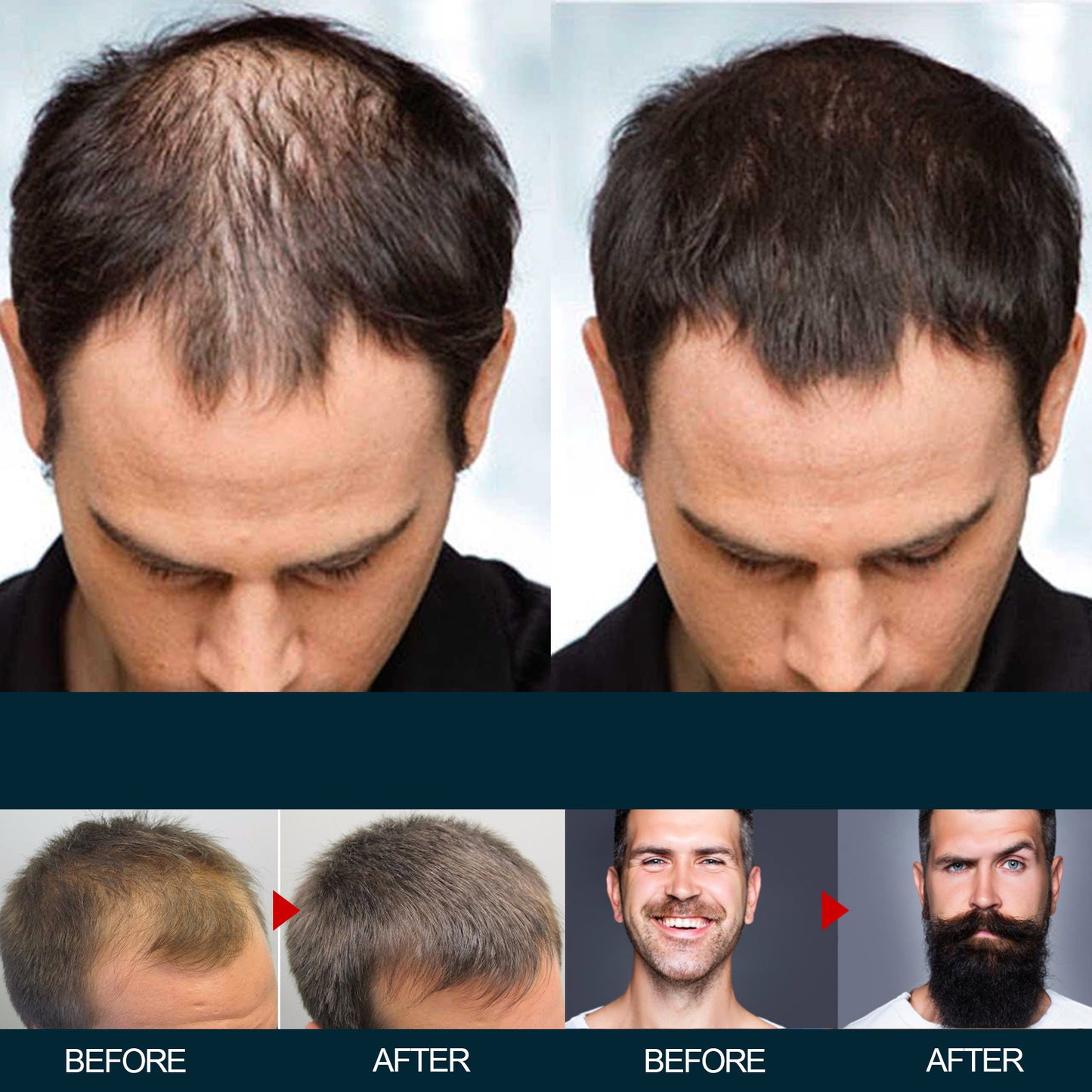 B-READY Men's Hair Nutrition Care Anti-hair Fixing Thick Moisturizing Minoxidil