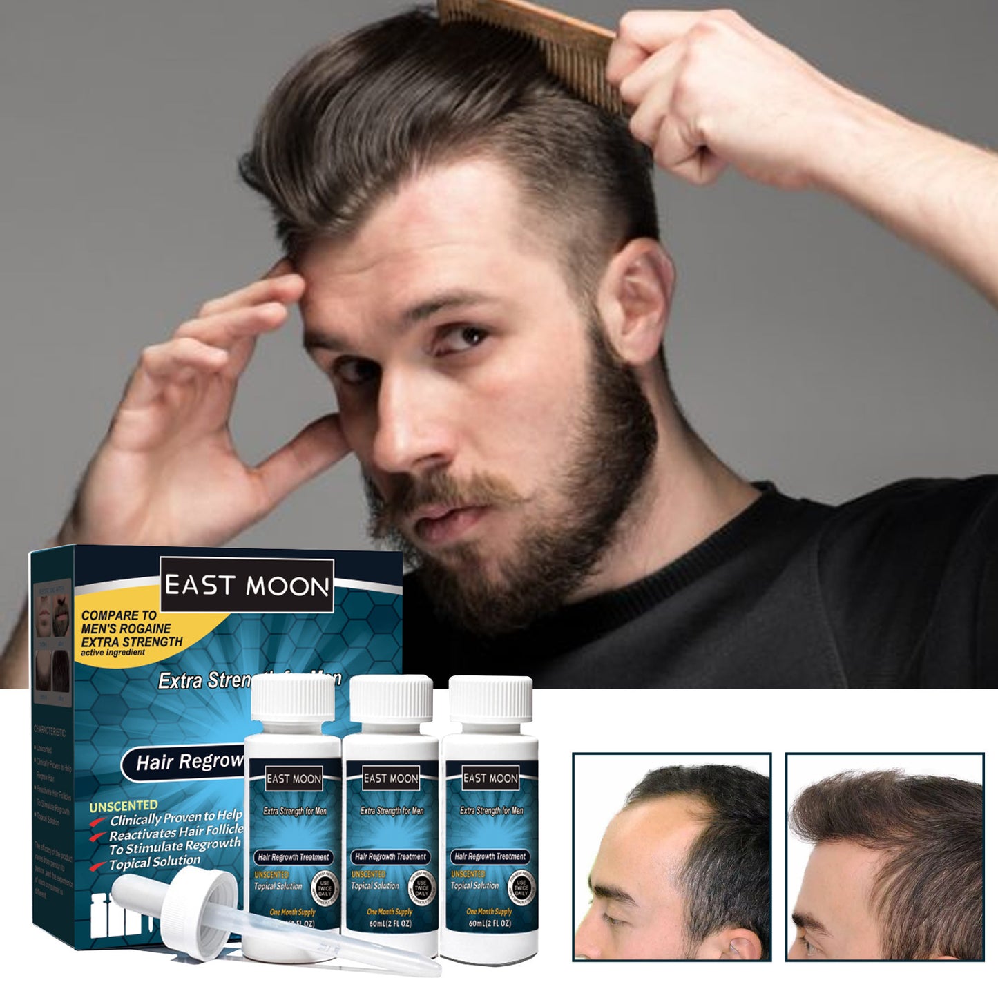 B-READY Men's Hair Nutrition Care Anti-hair Fixing Thick Moisturizing Minoxidil