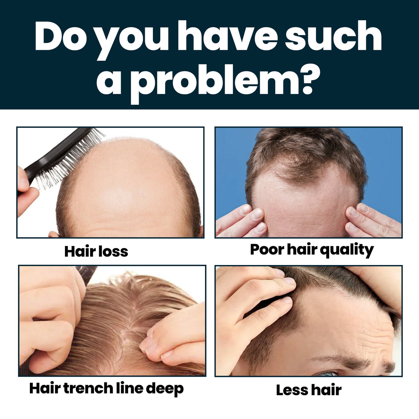 B-READY Men's Hair Nutrition Care Anti-hair Fixing Thick Moisturizing Minoxidil